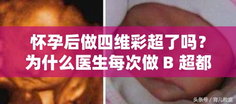 怀孕后做四维彩超了吗？为什么医生每次做 B 超都要问？