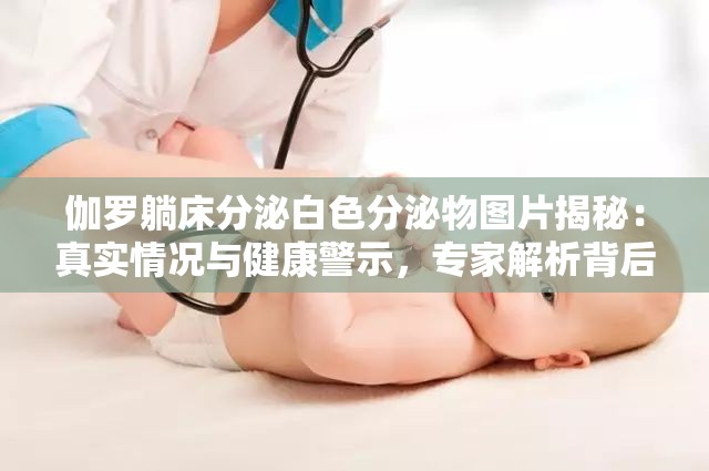 伽罗躺床分泌白色分泌物图片揭秘：真实情况与健康警示，专家解析背后的原因与应对措施